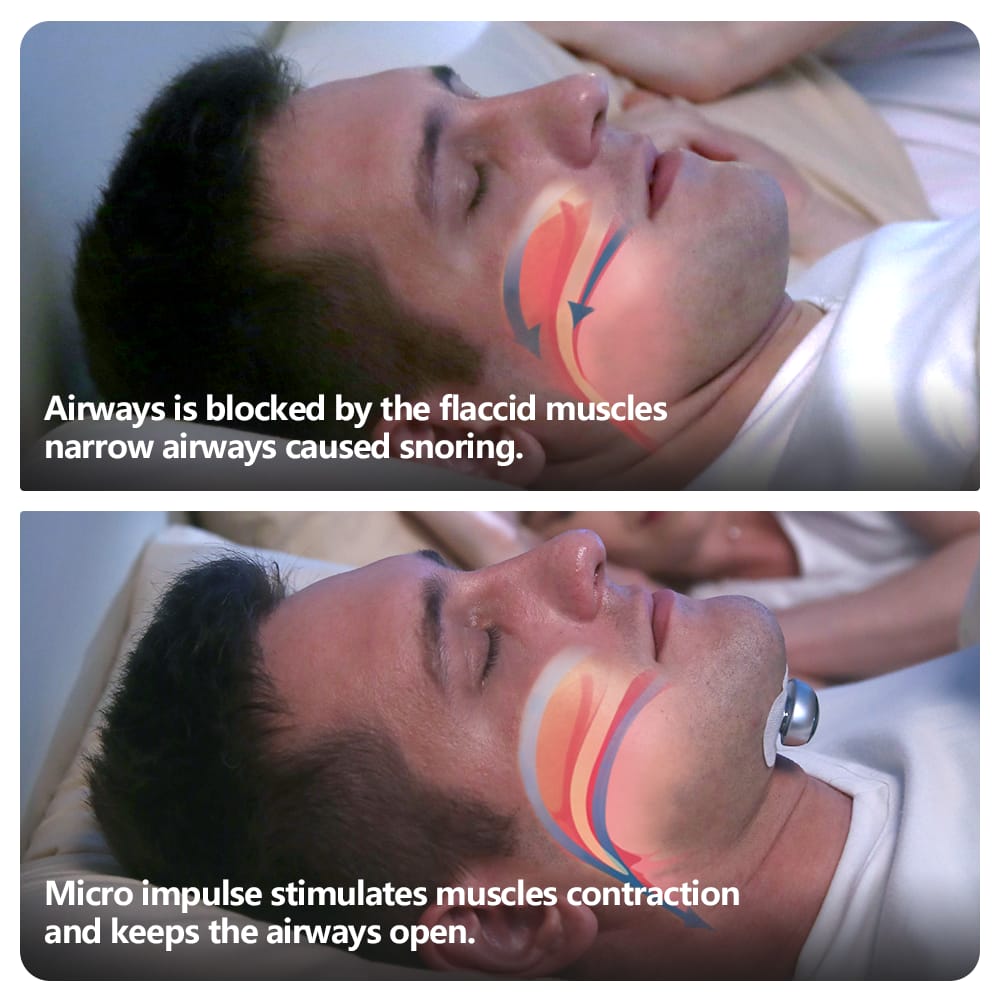 Snore Circle Pro - Snorecircle.eu